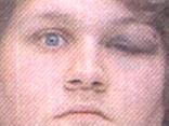 Phillies Puker Pleads Guilty to Assault