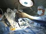 Robot Redefining Early Lung Cancer Treatment