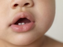 Free Dental Care Today