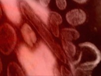 Chat Live About Swine Flu