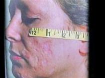 Carol Snyder Talks to NBC10 Investigator Harry Hairston