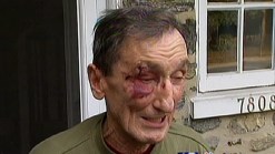 Elderly Man Attacked in Local Park