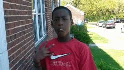 Boy Shot in Face by Friend