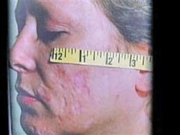 Carol Snyder Talks to NBC10 Investigator Harry Hairston