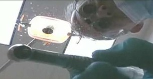 "Dental Button" Calms Fears in the Dentist's Chair