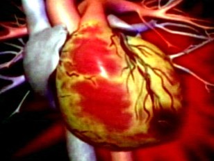 Everyday Events Deadly for Rare Heart Condition