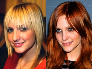 Plastic Surgery? Celebrities Then and Now