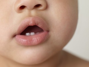 Free Dental Care Today