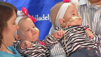 Separated Twins Debut