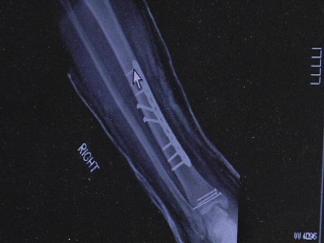Pa. Doc Gets Baver Back to Speed