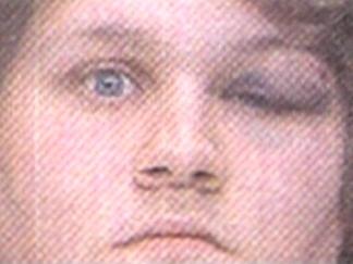 Phillies Puker Pleads Guilty to Assault