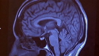 Help Prevent Those Forgetful Senior Moments