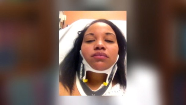 Woman Sues Over Alleged Police Brutality 
