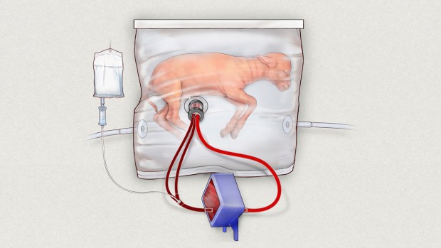 [NATL] New Artificial Wombs Stimulates Mom for Preemies 