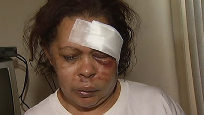 57 year-old Christina Santos talks about the vicious beating she endured inside her North Philadelphia deli.