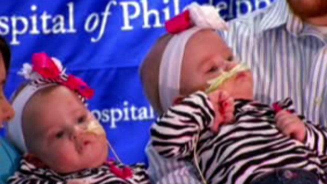 Conjoined twins successfully separated at CHOP made their Philadelphia debut on Thursday. NBC10's Marisa Brahney spoke to the mother and father of the little Allison and Amelia Tucker.