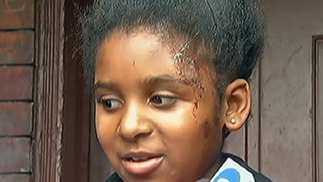 Third grader Aijahnae Johnson was riding her bicycle Tuesday evening when she was struck by a car. 