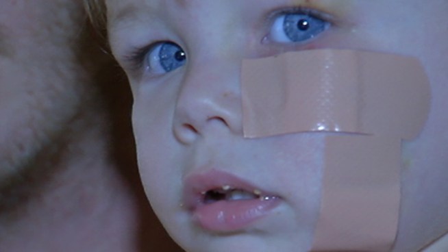 A little boy was attacked by a dog while he and his family were at James Memorial Park in Bucks County on Saturday. The toddler was hospitalized from the bites on his face and police are trying to track down the animal and it's owner.