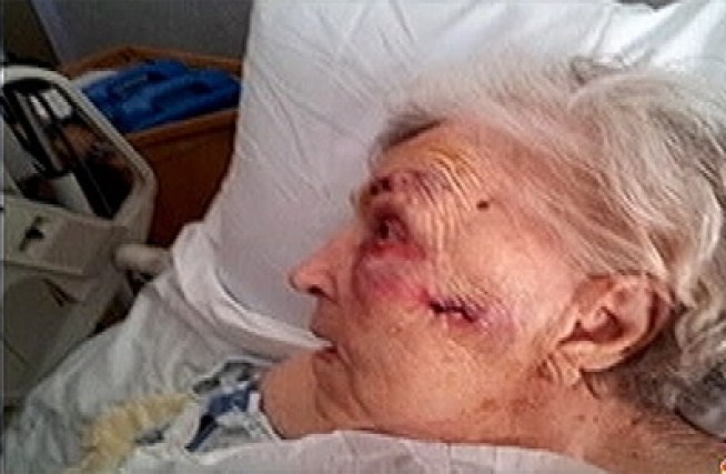 Police in the Rhawnhurst section of Northeast Philadelphia are still looking for the person who attacked an 86 year old woman in her own home. Eve Rulevskaya remains in serious but stable condition at Aria Torresdale Hospital. 