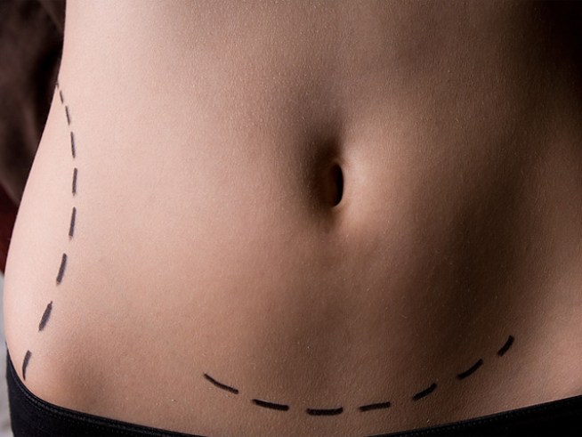 Plastic Surgery iPhone App: Medical Aid or Just Plain Creepy?