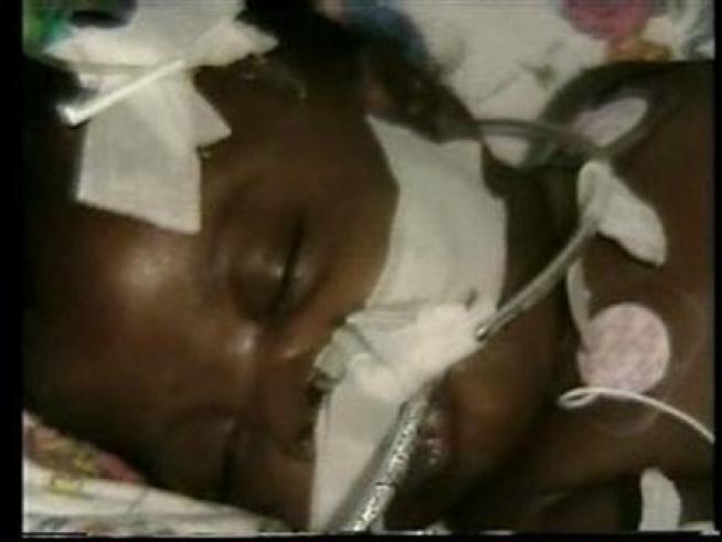 Video of the twin that died after given an overdose of medication while inside the hospital the day after being born.