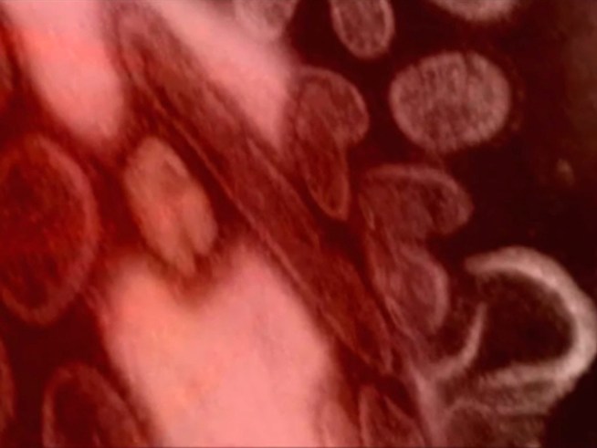 Chat Live About Swine Flu