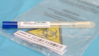 A generic coronavirus test