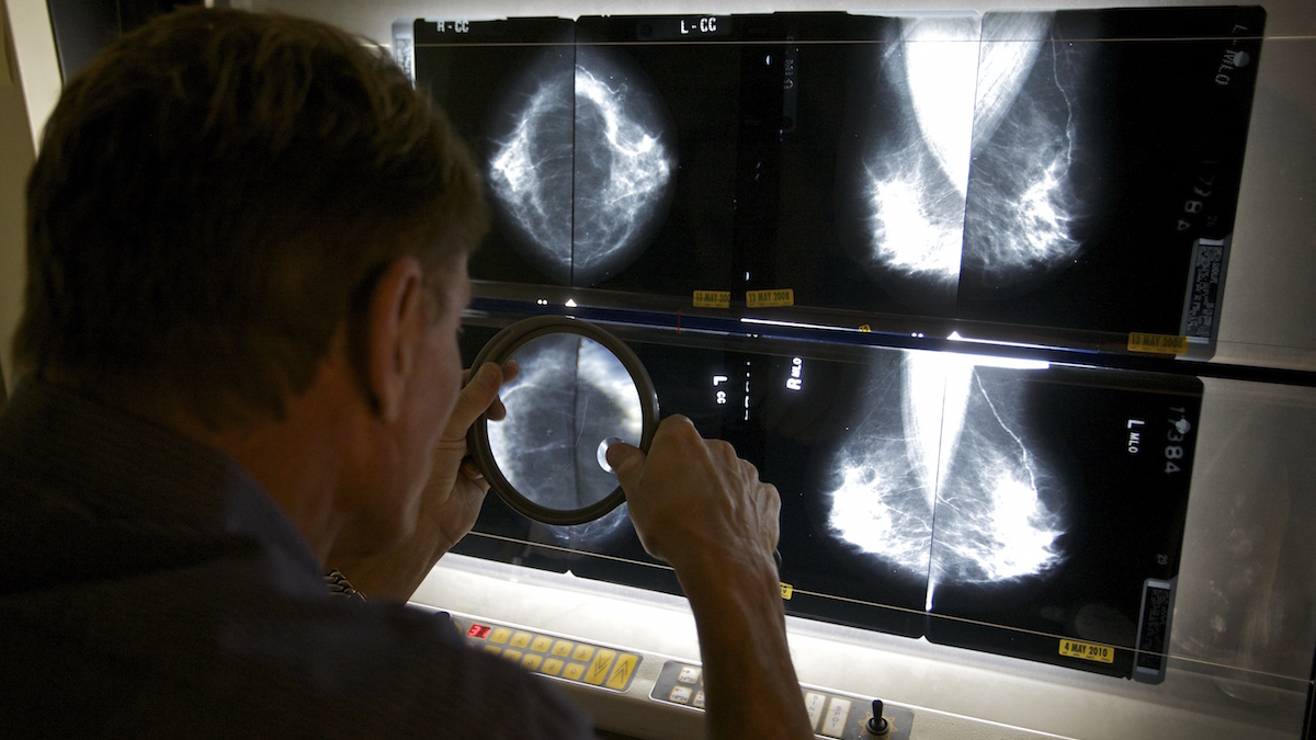 Can a mammogram help identify heart disease?