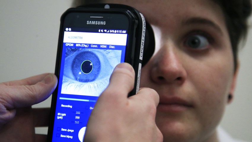 APTOPIX Measuring Pain