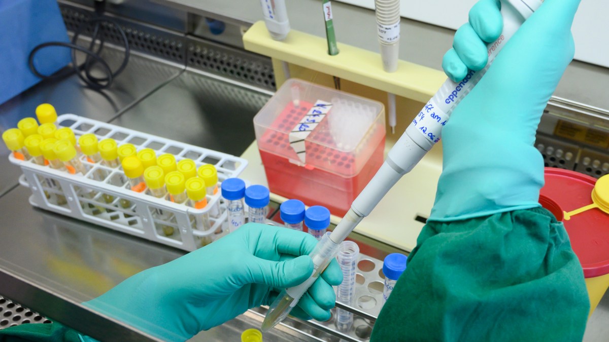 Pennsylvania Begins Coronavirus Testing at Stateowned Lab NBC10