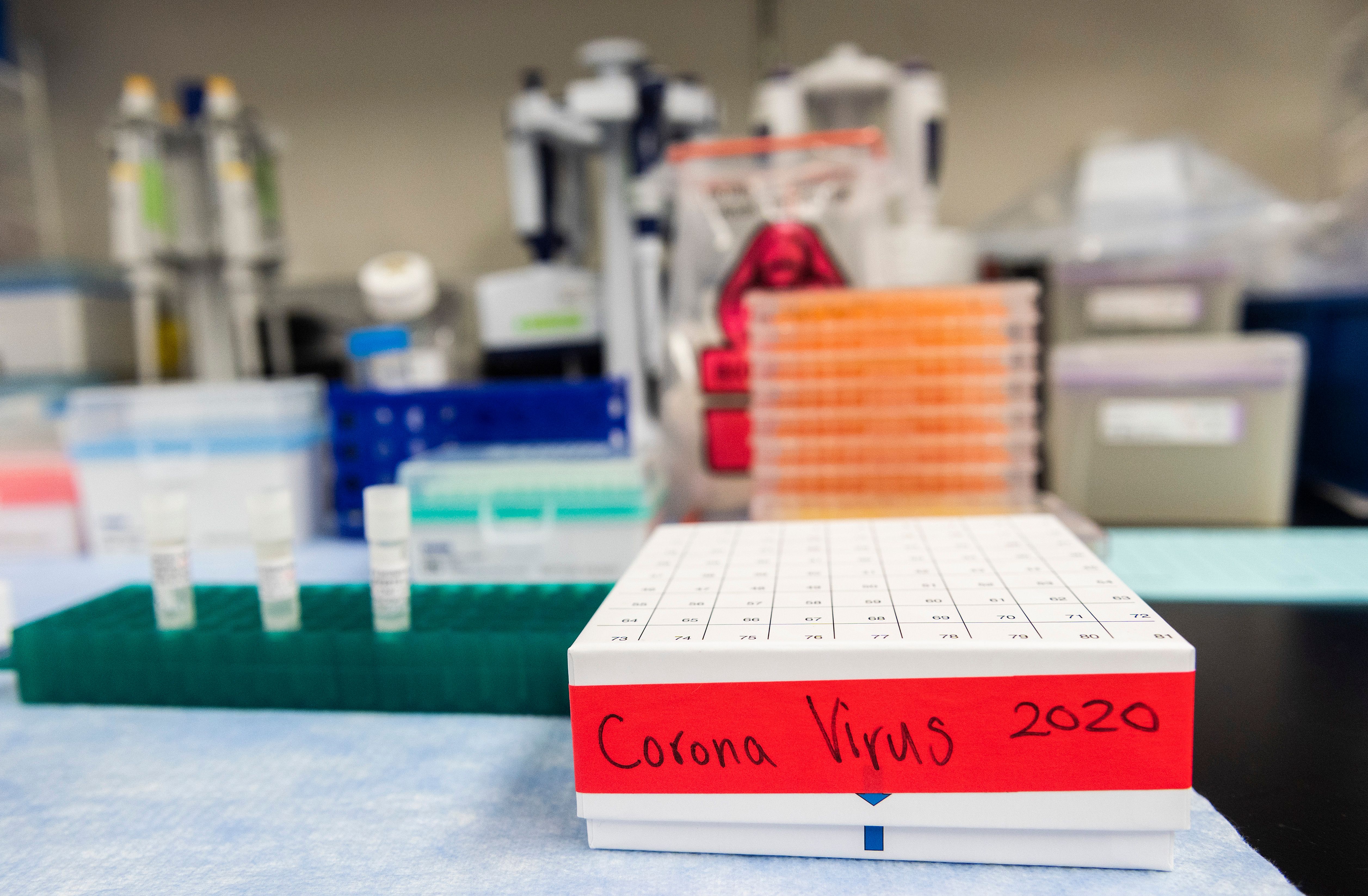 Three potential coronavirus, COVID-19, vaccines are kept in a tray; lab equipment is in the background