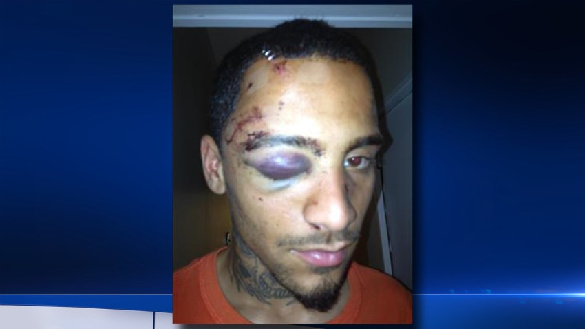 Najee Rivera beating injuries bg
