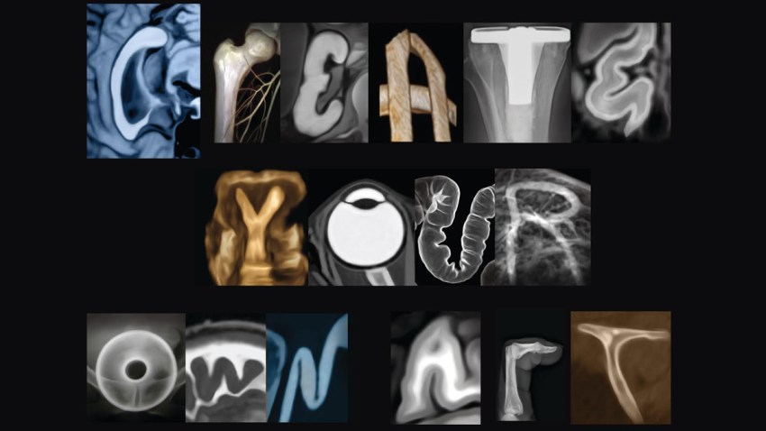 XRay Art 1