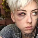 artist punched