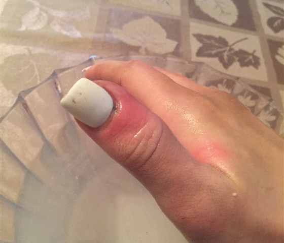 karolina_jasko_nail_124786180ebca6834b7e64a1951949ab.fit-560w