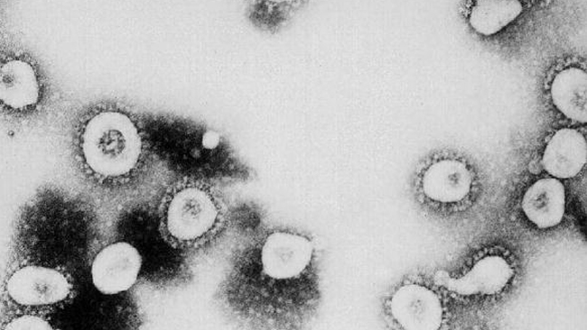 A microscopic view of the coronavirus at the CDC in Atlanta, Georgia. The virus that causes Severe Acuste Respiratory Syndrome (SARS) might be a "previously unrecognized virus from the coronavirus family," the CDC said.
