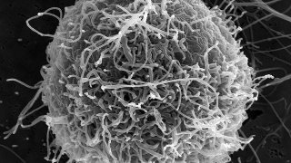 Ebola virus particles