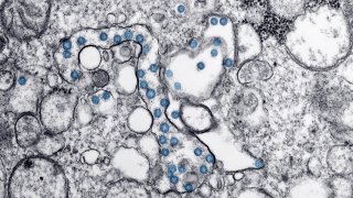 Transmission electron microscopic image of an isolate from the first U.S. case of Covid-19. The spherical viral particles, colorized blue, contain cross-sections through the viral genome, seen as black dots.