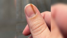 The tan streak on Maria Sylvia's nail