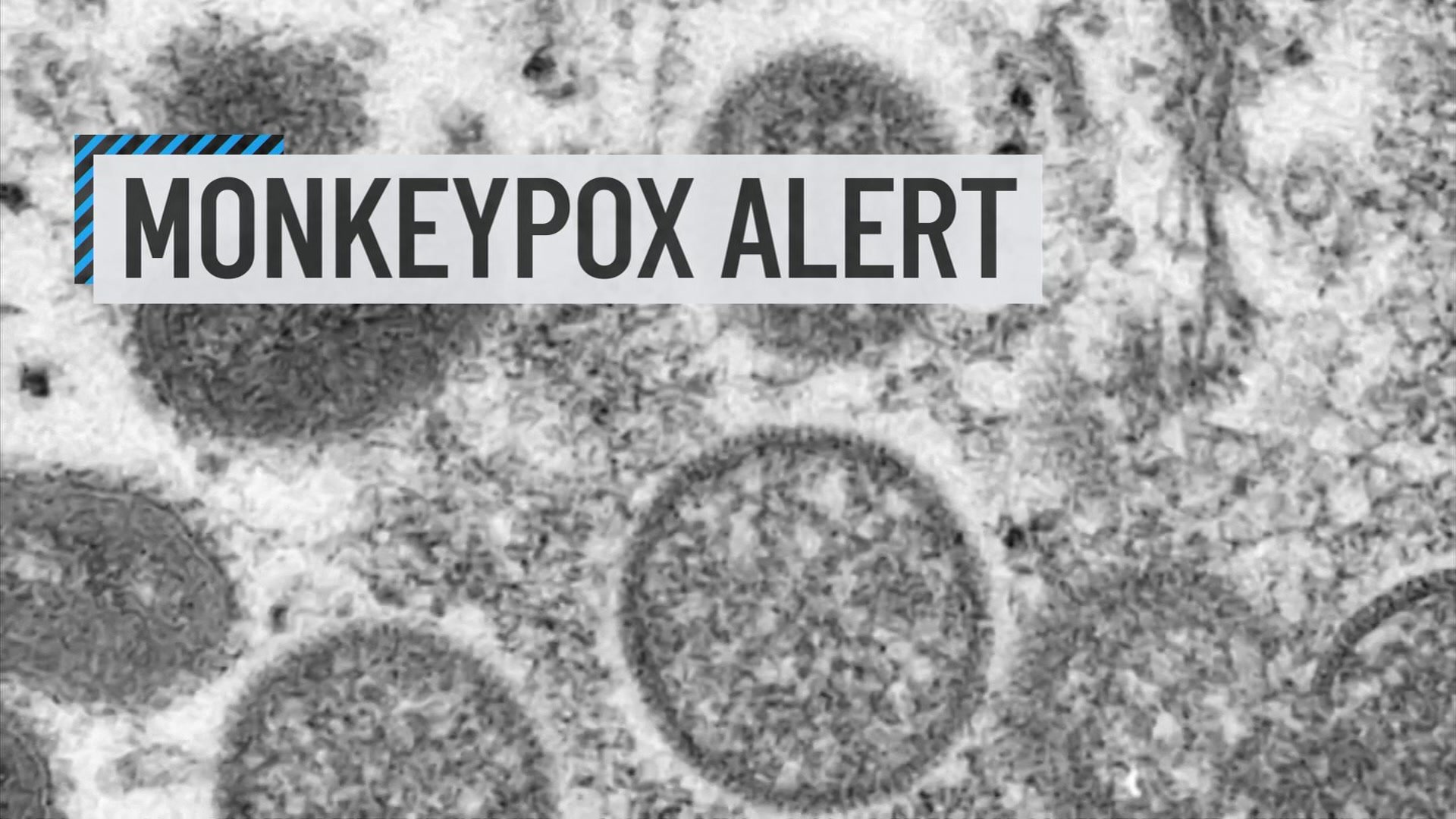 Monkeypox, Now a Global Emergency, Has Been Found in PA, NJ and Delaware – NBC10 Philadelphia - Vimarsana News