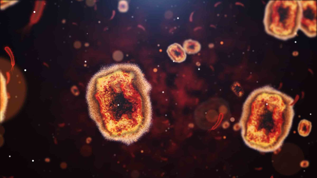 237 Monkeypox Cases Now Reported in Philly, NJ – NBC10 Philadelphia - Vimarsana News