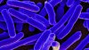 Boil water advisory issued for Salem City area after E. coli detected