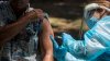 Monkeypox Eradication Unlikely in the U.S. as Virus Could Spread Indefinitely, CDC Says