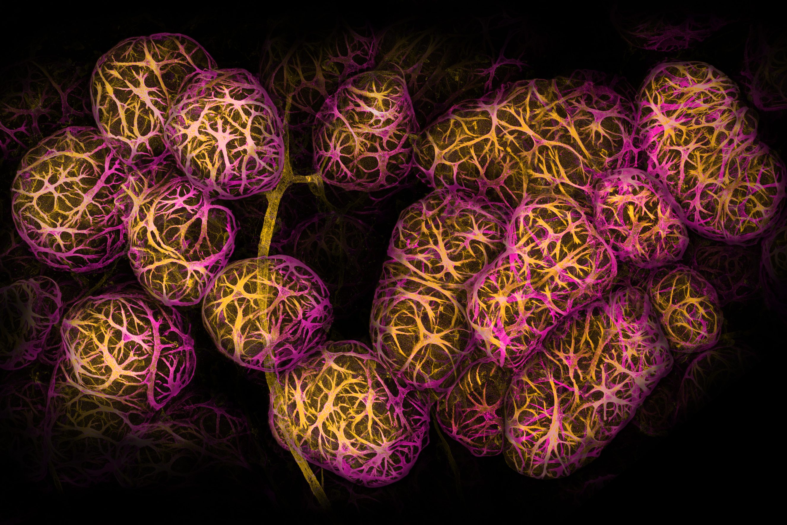 Breast tissue showing cells responsible for human milk production (alveoli).