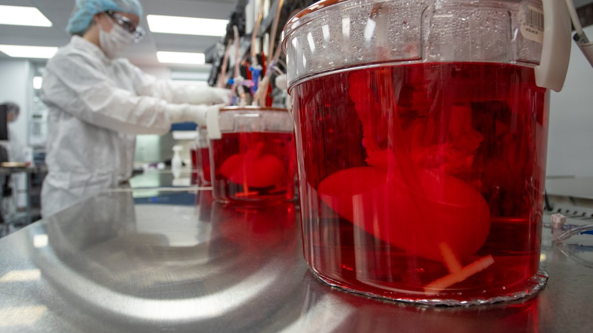 Scientists Seek to Use Pig Livers to Ease Organ Shortage – NBC10 Philadelphia - Vimarsana News