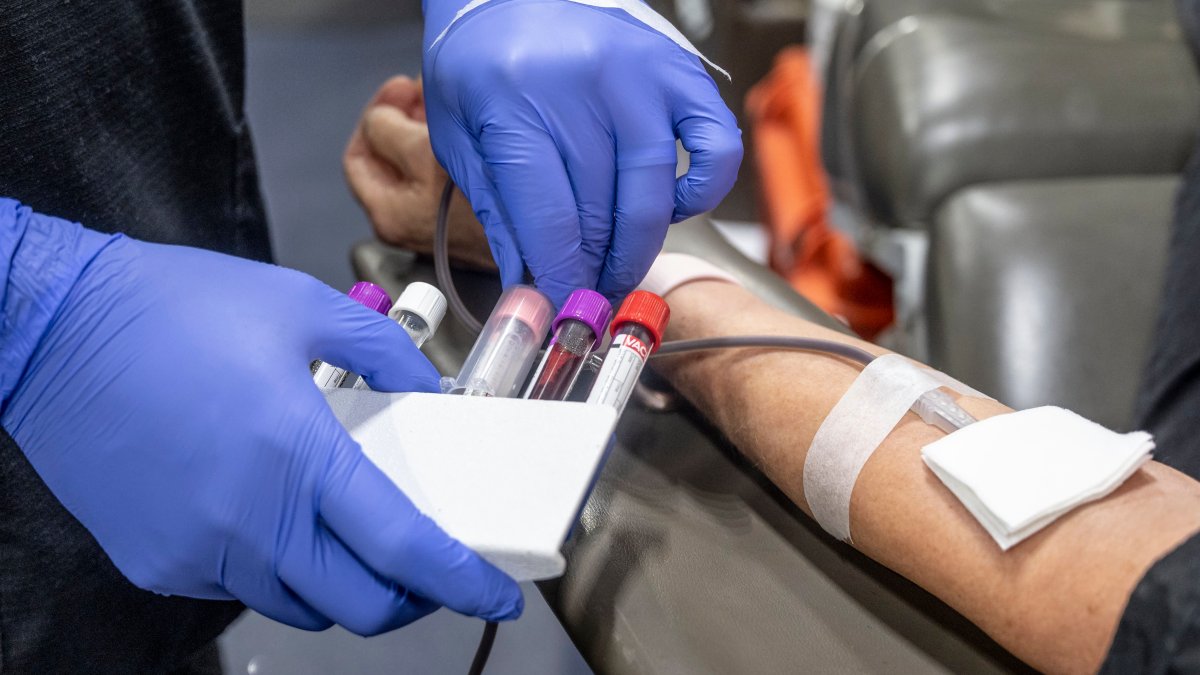 FDA Proposal Would Allow Gay Men in Monogamous Relationships to Donate Blood - Vimarsana News