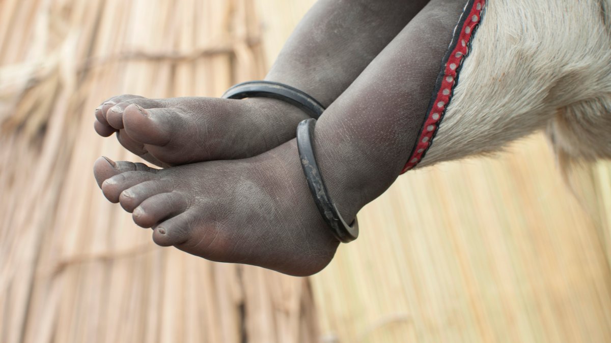 300 children rescued after 71 died in a Sudanese orphanage – NBC10 Philadelphia - Vimarsana News