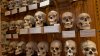 Mütter Museum seeks public's help over the future of human remains collection