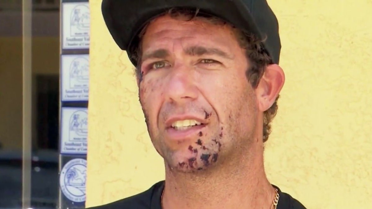 Surfer recalls getting bit in the face by shark at Florida beach – NBC10 Philadelphia - Vimarsana News