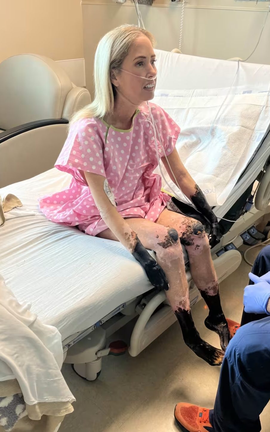 Moody's extremities turned black in the hospital. "The doctor said, 'We're either going to save her life or we're going to save her limbs,'" her husband recalls.